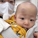 김유훈 | 10개월 아기 낙상, 우리아이들병원 진료후기
