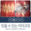 서울교정치과기공소 이미지