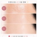 알로에마임 - 안산시 단원구 새뿔길 52 | 투앤티크림 후기| 피부가 뒤집어졌는데도 계속 사용한 이유 (4주후기·사용법·부작용)