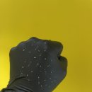 경일메디칼 | 대구에스테틱 샵 "솔에스테틱" 프리미엄 여드름 케어 후기 (첫방문 20% 할인) 비포애프터 있음