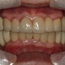 삼아치과기공소 이미지