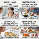 연세신경과의원 | [아산 연세원치과]사랑니 발치 후 첫 식사, 꼭 죽만 먹어야 할까요?