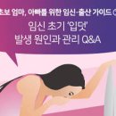 임신극초기증상은? 냉 가슴 아랫배 허리 통증 포함 6가지, 임신극초기 시기 이미지