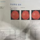 이을아이두의원 네이버블로그