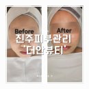 더안헬스케어 | 진주 주약동 피부관리, 더안뷰티샵 문제성피부관리 솔직한 리뷰(수부지, 붉은기, 트러블 관리)