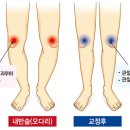 알스텝