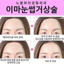 엔도픽스 이미지