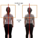 반송동243 | 반송동 체형교정 필라테스, 비포·애프터로 보면 차이가 보입니다