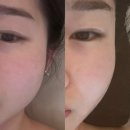 위례역사길 | (위례 피부관리) 미오에스테틱에서 윤곽관리 받은 후기🛁