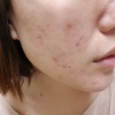 강남신광한의원 이미지