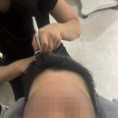 (주)모앤크리에이티브 | 부산두피관리 모앤두피탈모 여름철 열감을 시원하게 낮춰주는 해운대탈모관리