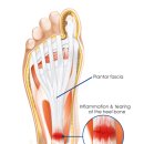 엠디디피티 이미지