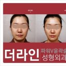 더브이라인