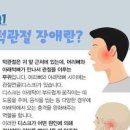 씹을때 귀통증 귀에서 소리, 한쪽귀가 먹먹할때 이미지