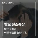 삼성의원 | 포항탈모성지 삼성의원 - 놓치기 쉬운 탈모 전조증상