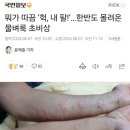 [국내이슈] 급격히 늘어난 피부병 이미지