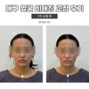 리샘한의원 대구점 | 대구 얼굴비대칭 교정 후기, 안면비대칭 교정으로...관리했어요 대구 안면비대칭 교정 한의원 방문기