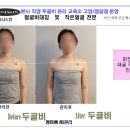 클리니스킨 이미지