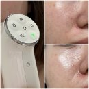 씨제이원 | 쿼드쎄라 펜타 내돈내산 가정용 ldm 86만원 효과 후기와 구매 꿀팁