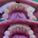 서울장플란트치과의원 이미지