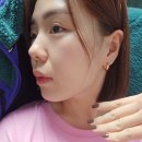 순자 | 인천 부평 올타이트 순자리프팅 효과 후기 즉각 리프팅 볼패임 걱정없이 자연스럽게 찐이야