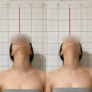 대신동 국민은행 앞 횡단보도 | [공지] [비체 스킨앤바디랩] 입체탄력리프팅 관리 후기