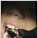 에이라인치과병원 | 건강하고 아름다운 미소! 자연스럽게 치아를 하얗게 만드는 방법/에이라인치과병원