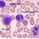 염증수치(WBC, CRP, ESR) 이미지