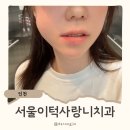 반치과 | 구월동 서울이턱사랑니치과 매복 사랑니 발치 못할뻔한 후기