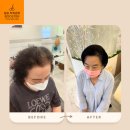 삼송마을16_17단지 | 도래울마을 두피문신 후기｜신원동 삼송마을 정수리 탈 ,모 자연스럽게 채우는 방법