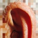 울림숲난청연구소 보청기 이미지