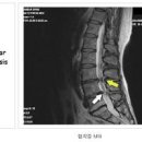 허리 아플때 등 허리 다리 통증 이유 이미지