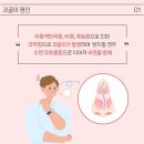 나만 모르는 소리?! 코골이, 왜 생길까요? 이미지