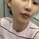샘 - 남구 | 국산 입술필러 추천 신논현입술필러 에버샘의원 방문 후기