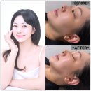 미모미모 | 일산 비수면 리프팅 , 플라즈마 잘하는 &#34;미모부심&#34; 솔직후기!