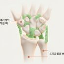 김포튼튼한의원 | 손목이 삐었을 때 파스만 붙이지 말고 침 치료받으세요.