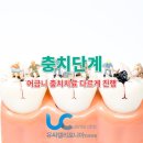 우주치과기공소 | 어금니 충치단계 별 치료 방법 다르게 진행 했던 이유