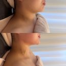 지플러스타워 | 약손명가 양악관리 후기 구로디지털점 추천