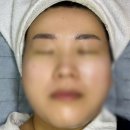 봉천약국 | 봉천피부관리 블랙여우 왁싱&amp;속눈썹에서 풀페이스왁싱 두번째 방문후기