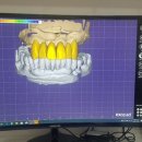 이치과기공소 이미지