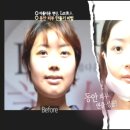 렛미인피부