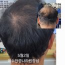 희망랩 네이버블로그