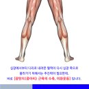 하지정맥류 치료나 수술을 보류해야 하는 사람은? 이미지