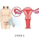 여자 아랫배 통증 이유 및 치료 진단 방법 알아봐요 이미지