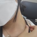 씨티팜대학약국 | 두드러기 혈관염인가..땀띠인가 아직도 모름(2022.06~07)