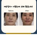 [전남 광주,순천] 안면비대칭 안와뼈의 비밀, 1/31일 두골비협회장님을 직강 순천세미나 이미지