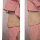 웰니스케어 | 천안 에너지명가 웰니스리셋케어 후기