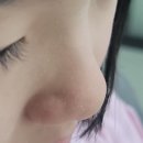 사춘기 지성 홈케어 노일리 스킨 수면팩, 효소클렌저 내돈내산 후기