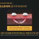 아스테리아(ASTERIA)