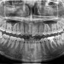 더바른윤치과의원 이미지